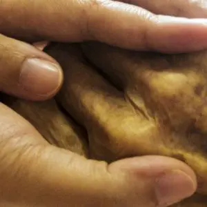 Nutrition and exercise interventions in cancer and cachexia